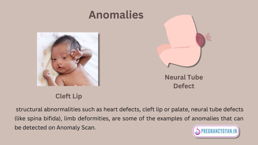 anomalies meaning