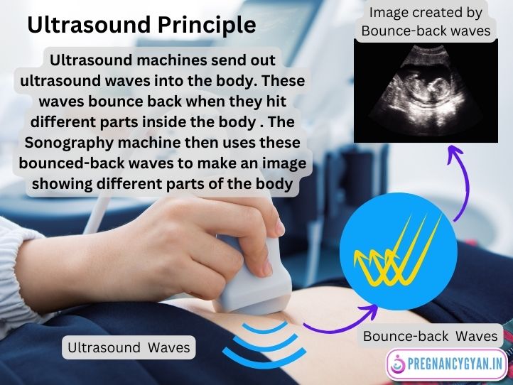 ultrasound principle