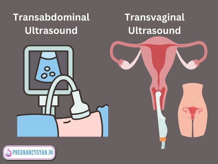 tvs ultrasound and abdominal ultrasound