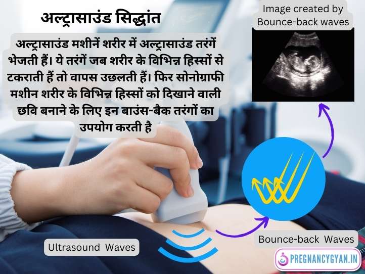 doppler ultrasound in pregnancy