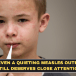 Why Even a Quieting Measles Outbreak Still Deserves Close Attention